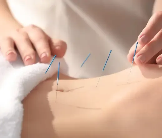 IMS Therapy for Muscle Pain: How It Works and Who Can Benefit?